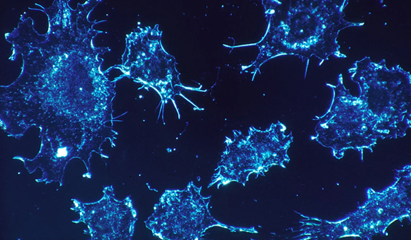Cientistas destroem 99% das células cancerígenas em laboratório